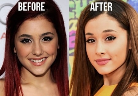 A picture of Ariana Grande lips looks so different in both pictures.
